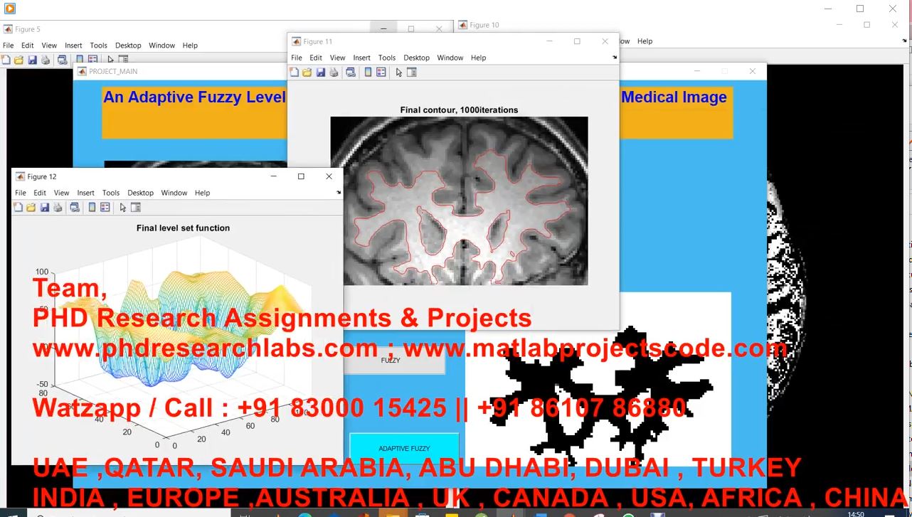 An Adaptive Fuzzy Level Set Model With Local Spatial Information For Medical Image Segmentation project simulation thumbnail for Control Systems Engineering