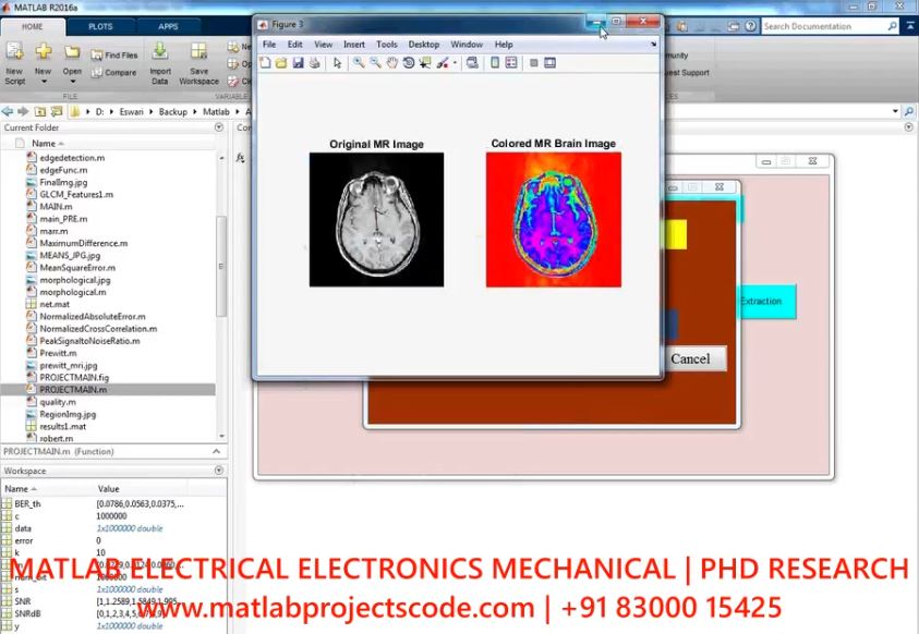 Brain Tumor Classification Using Edge Detection And Cnn project simulation thumbnail for Signal Processing and AI Engineering