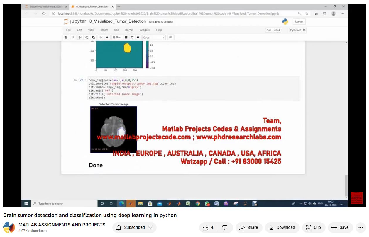 Brain Tumor Detection And Classification Using Deep Learning In Python-Matlab Simulink-Electrical Assignments-Projects-Phd Research project simulation thumbnail for Signal Processing and AI Engineering