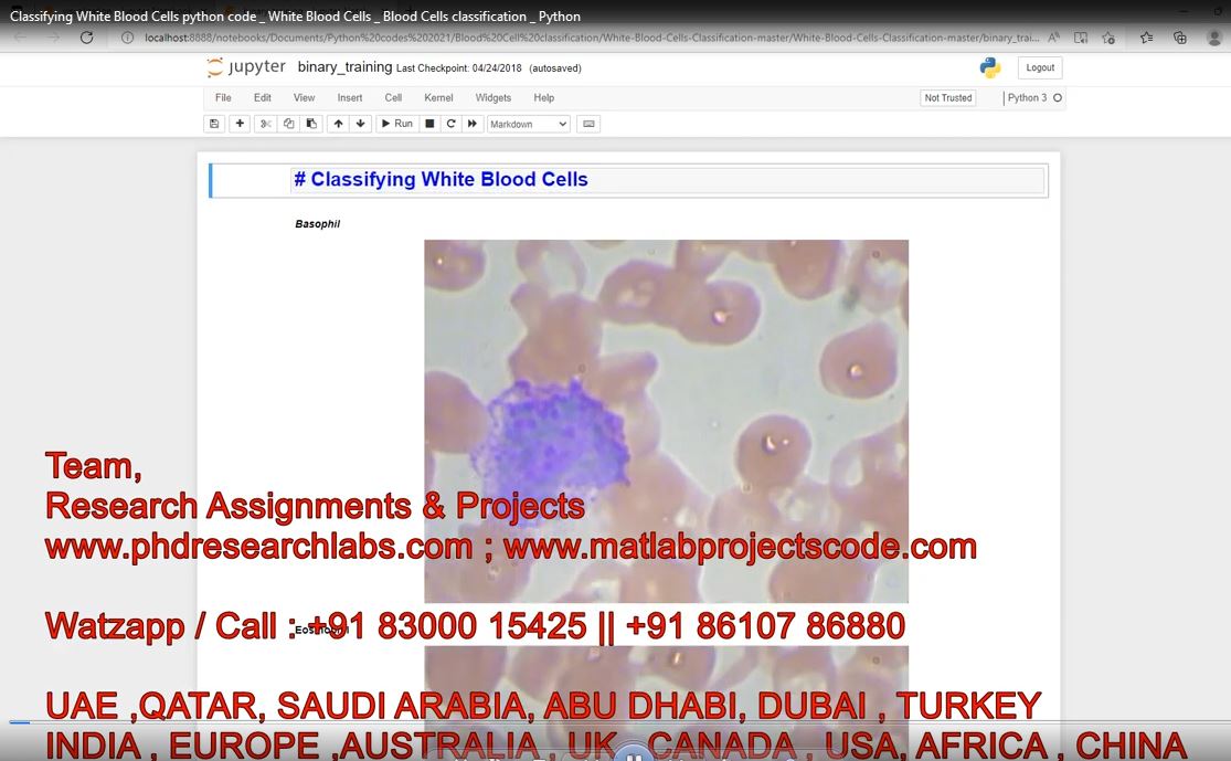 Classifying White Blood Cells Python Code _ White Blood Cells _ Blood Cells Classification _ Python project simulation thumbnail for Signal Processing and AI Engineering