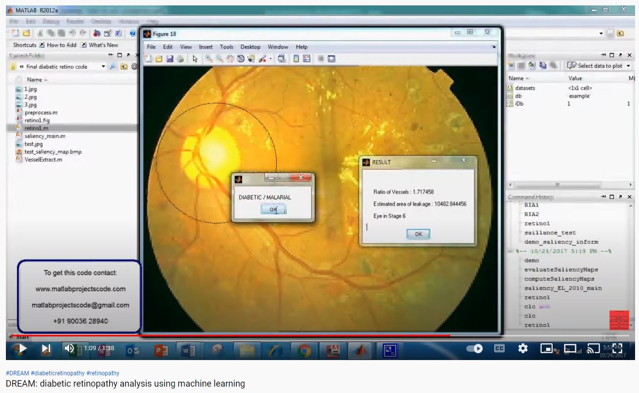 DREAM_diabetic Retinopathy Analysis using Machine Learning project simulation thumbnail for Electrical Engineering