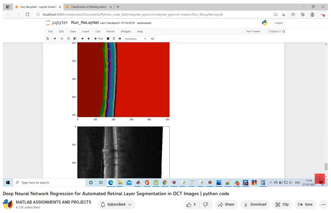 Deep Neural Network Regression For Automated Retinal Layer Segmentation In Oct Images _ Python Code project simulation thumbnail for Signal Processing and AI Engineering
