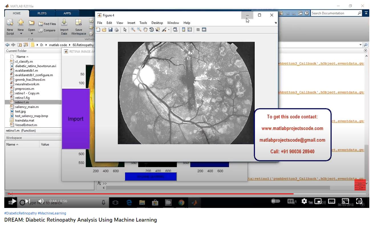 Diabetic Retinopathy Analysis using Machine Learning project simulation thumbnail for Electrical Engineering