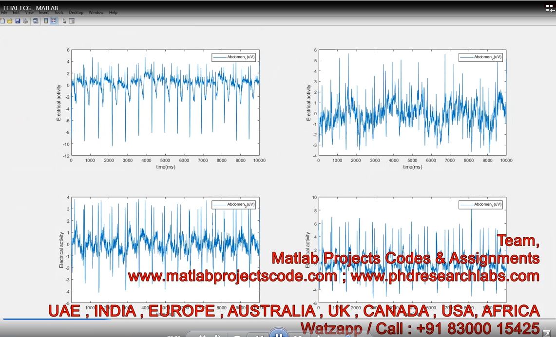 Fetal Ecg _ Matlab project simulation thumbnail for Electronics Engineering