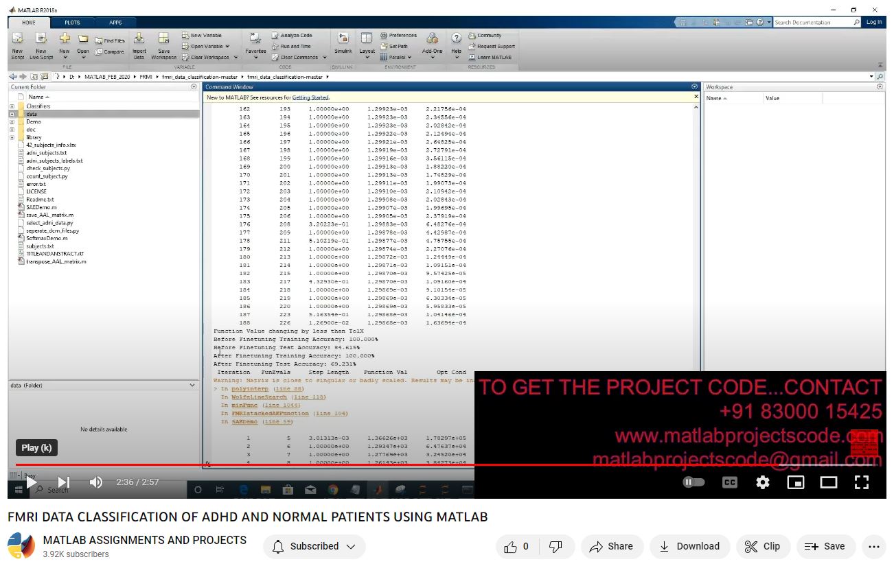 Fmri Data Classification Of Adhd And Normal Patients Using Matlab project simulation thumbnail for Signal Processing and AI Engineering