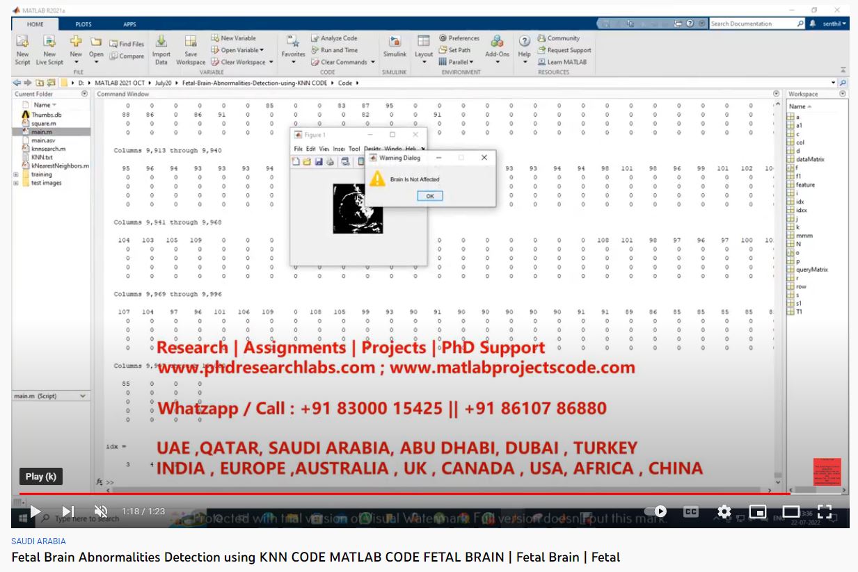 Fetal-Brain-Abnormalities-Detection-using-KNN CODE -MATLAB CODE- FETAL BRAIN project simulation thumbnail for Signal Processing and AI Engineering