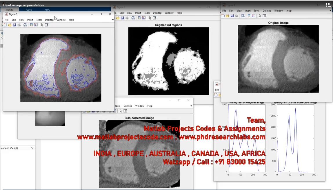 Heart Image Segmentation project simulation thumbnail for Signal Processing and AI Engineering