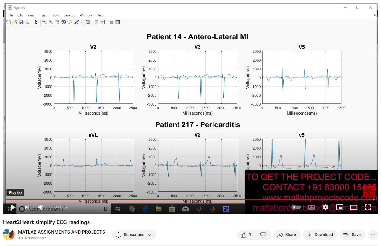 Heart2Heart Simplify Ecg Readings project simulation thumbnail for Electrical Engineering