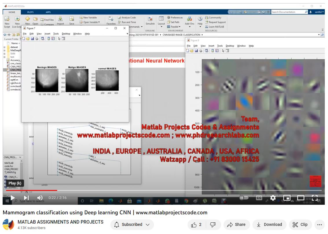 Mammogram Classification Using Deep Learning Cnn project simulation thumbnail for Signal Processing and AI Engineering
