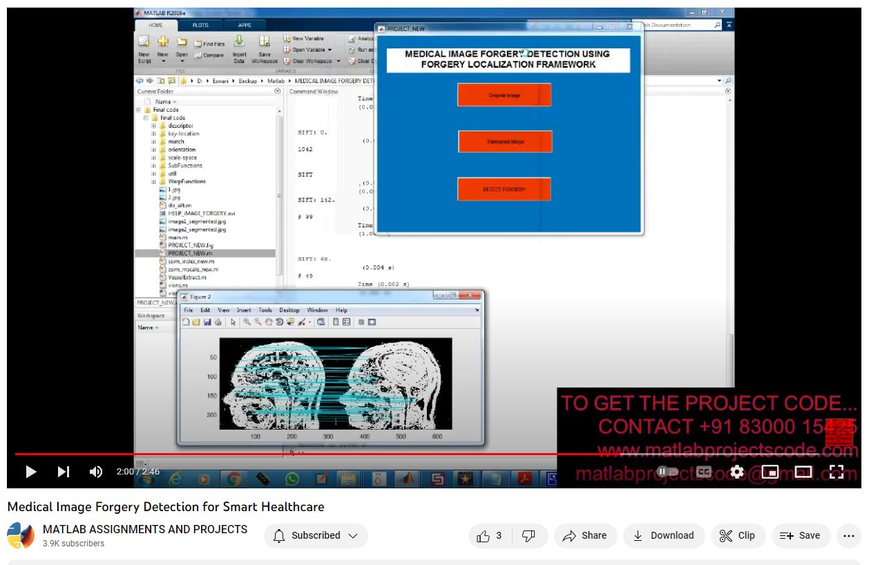 Medical Image Forgery Detection For Smart Healthcare project thumbnail image