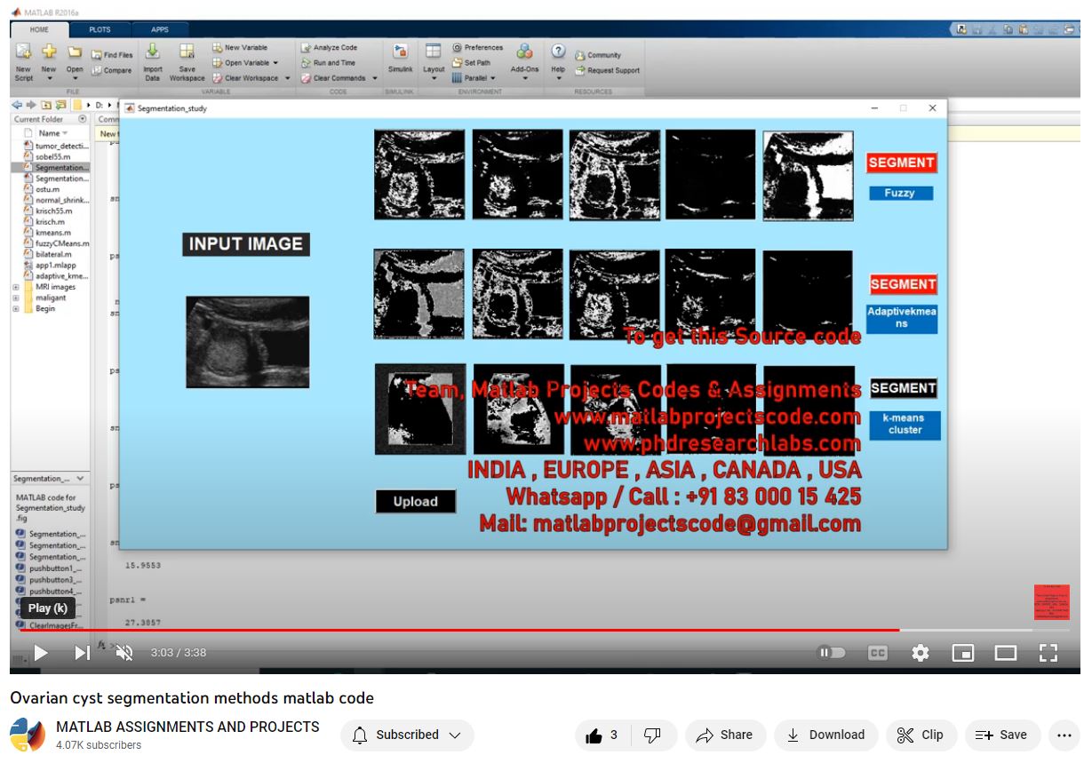 Ovarian Cyst Segmentation Methods Matlab Code-Matlab Simulink-Electrical Assignments-Projects-Phd Research project simulation thumbnail for Signal Processing and AI Engineering