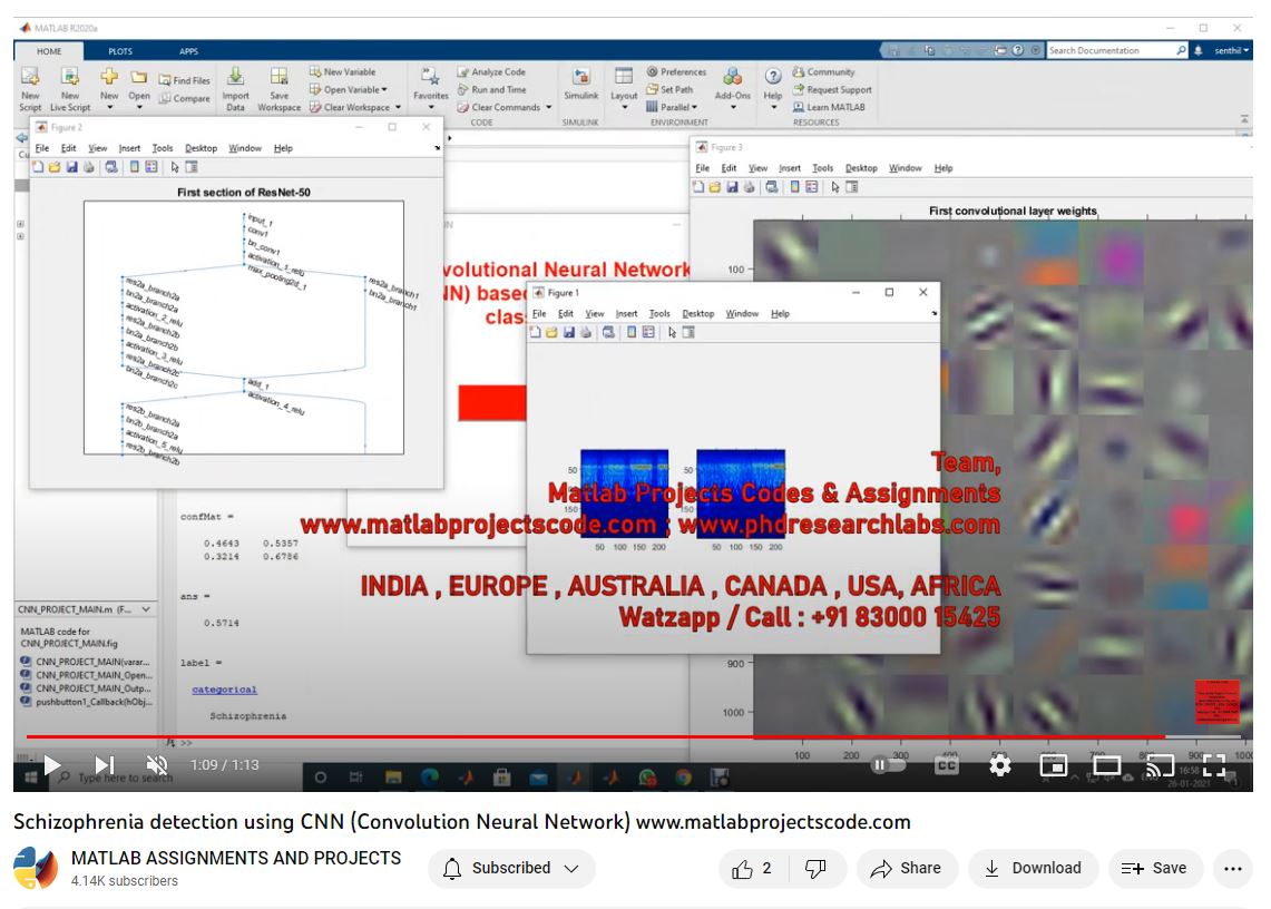 Schizophrenia Detection Using Cnn Convolution Neural Network project simulation thumbnail for Signal Processing and AI Engineering