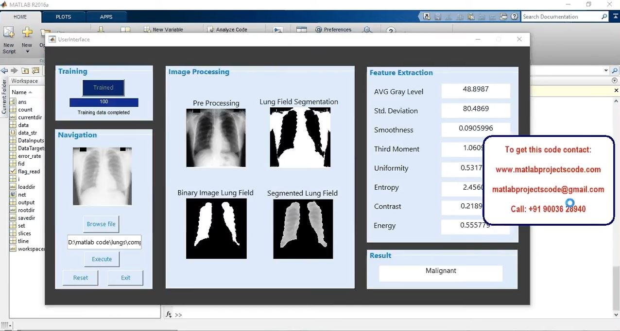 Tuberculosis Detection In Xray Images Using Matlab -Image Processing Project _ Matlab Assignments project simulation thumbnail for Signal Processing and AI Engineering