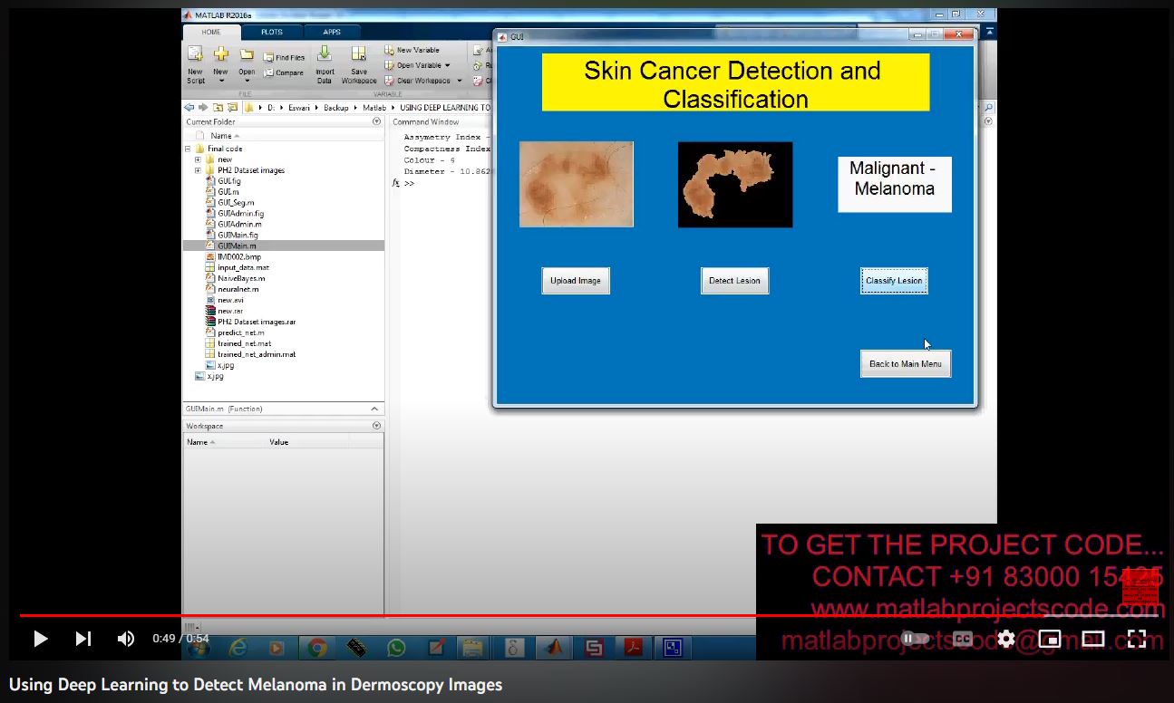 Using Deep Learning To Detect Melanoma In Dermoscopy Images project simulation thumbnail for Signal Processing and AI Engineering