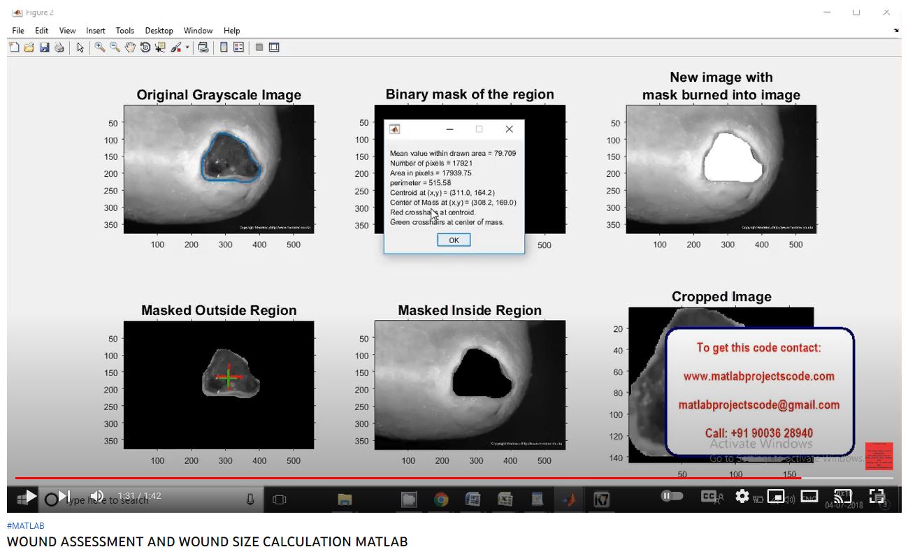 WOUND ASSESSMENT AND WOUND SIZE CALCULATION MATLAB project simulation thumbnail for Signal Processing and AI Engineering